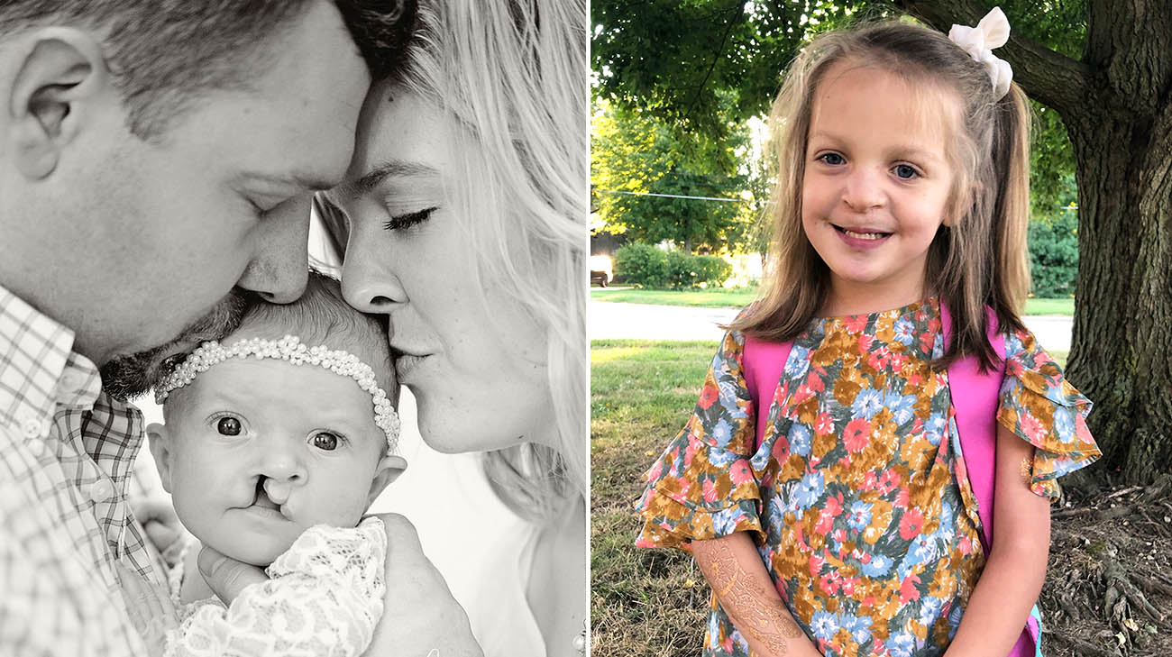 Whole genome sequencing identified Charlotte's rare disease as MED12-related disorder.